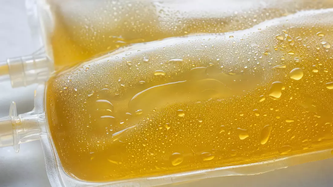 Makroaufnahme von gelblichem Blutplasma in transparentem Beutel