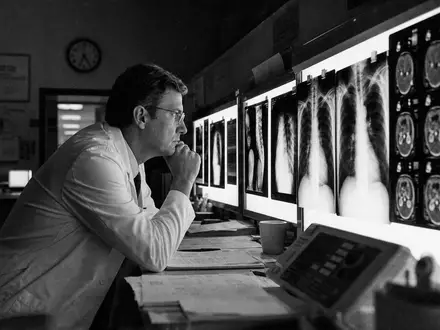 GE HealthCare US36266G1076 dokumentarisch: Radiologe studiert Röntgenbilder an beleuchteten Leuchtkästen im Labor - Foto: THN