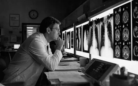 GE HealthCare US36266G1076 dokumentarisch: Radiologe studiert Röntgenbilder an beleuchteten Leuchtkästen im Labor - Foto: THN