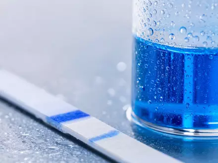 Makroaufnahme eines Diagnostik-Teststreifens, typisch für Branche von DiaSorin S.p.A., ISIN IT0003497168, mit feinen Details - Foto: THN