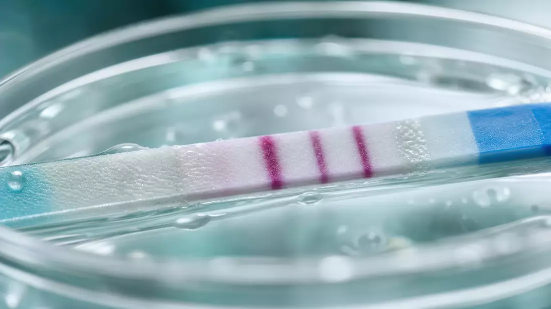 Makro: Diagnostischer Teststreifen mit lila Reaktionslinien in Petrischale, Teal-Bokeh