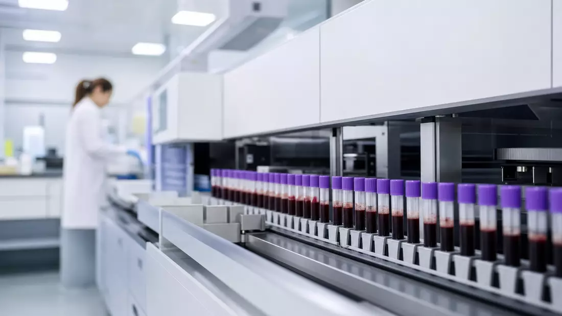 Automatisierter Laboranalysator mit Blutproben-Röhrchen in klinischem Diagnostiklabor