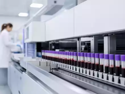 Quest Diagnostics US74834L1008 zeigt automatisierten Laboranalysator mit Blutproben in modernem Diagnostiklabor fotorealistisch dargestellt - Foto: THN