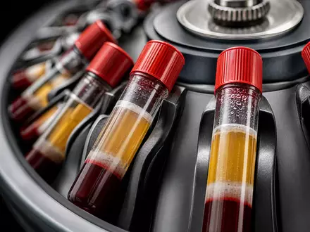 Quest Diagnostics US74834L1008 fängt Makroaufnahme rotierender Zentrifuge mit getrennten Blutproben-Schichten in Röhrchen dramatisch ein - Foto: THN