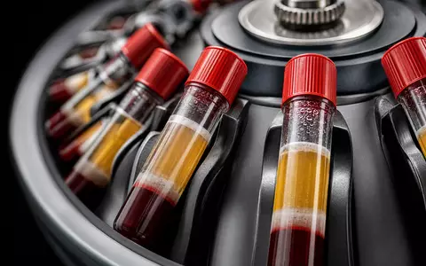 Quest Diagnostics US74834L1008 fängt Makroaufnahme rotierender Zentrifuge mit getrennten Blutproben-Schichten in Röhrchen dramatisch ein - Foto: THN