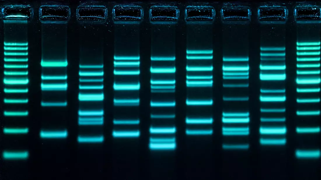 Extreme Makroaufnahme fluoreszierender DNA-Banden im Gelelektrophorese-Gel von Exact Sciences