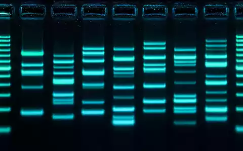 Exact Sciences Corp. nutzt DNA-Gelelektrophorese für präzise Krebsdiagnostik gezeigt in extremer Makroaufnahme US30063P1057 - Foto: THN