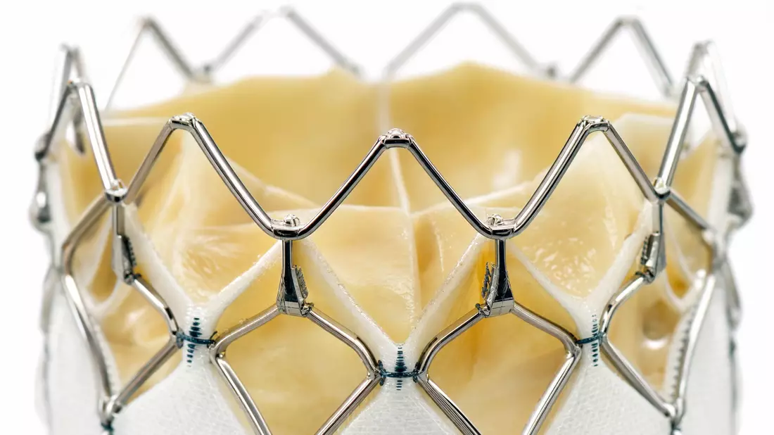 Extreme Makro-Nahaufnahme eines Nitinol-Herzklappen-Stents mit Gewebelamellen auf weißem Hintergrund