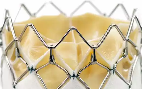 Edwards Lifesciences US28176E1082 Makro-Nahaufnahme eines Herzklappenimplantats aus Nitinol-Drahtgeflecht mit sichtbaren Gewebelamellen im Studio - Foto: THN