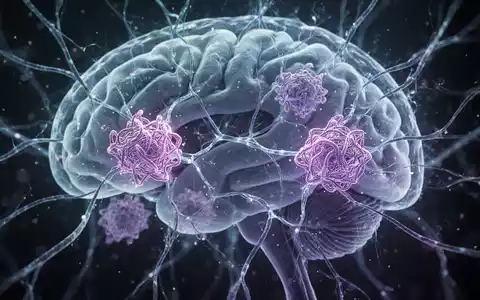 Abstrakte Darstellung von Nervenbahnen im Gehirn mit leuchtenden Verbindungen, die die Ausbreitung von Proteinen bei Alzheimer symbolisieren. - Foto: über boerse-global.de