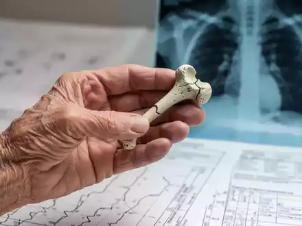 Eine Nahaufnahme einer älteren, zerbrechlichen Hand, die ein kleines, gebrochenes Knochenmodell hält. Im Hintergrund sind medizinische Diagramme zu sehen. - Foto: über boerse-global.de