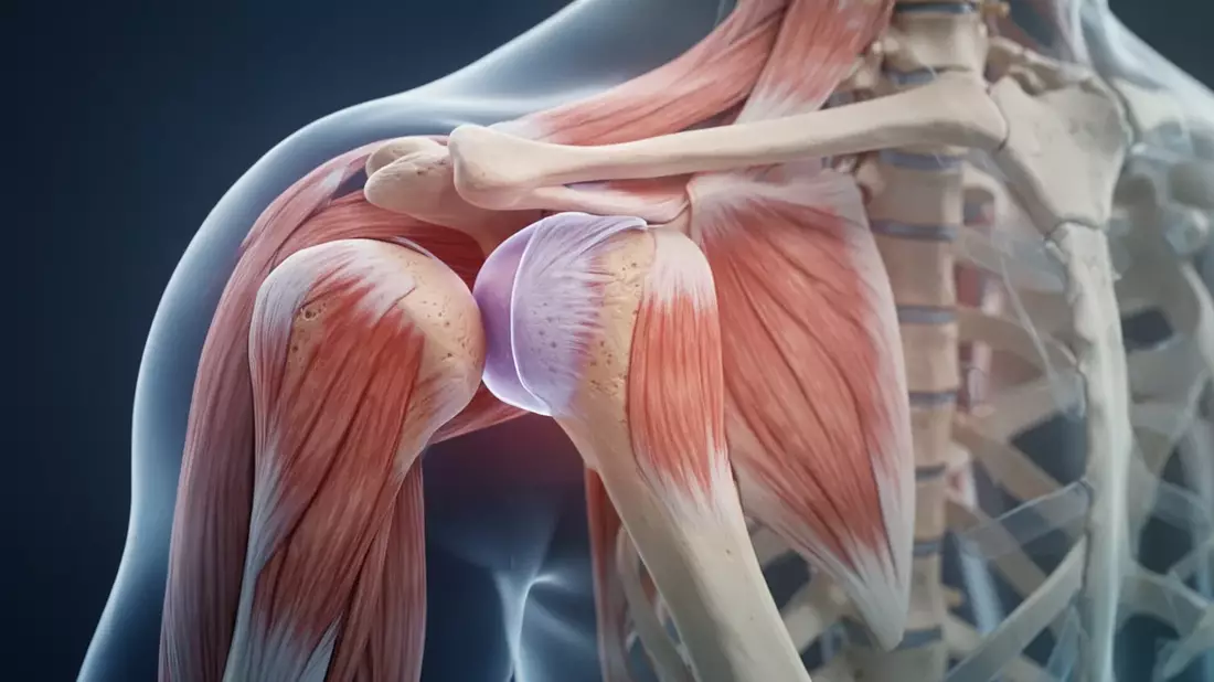 Impingement-Syndrom: Neue Therapien mit Robotik und KI