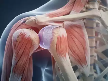 Eine Nahaufnahme des menschlichen Schulter- und Hüftgelenks mit Fokus auf Bereiche, die von Impingement betroffen sein könnten. - Foto: über boerse-global.de