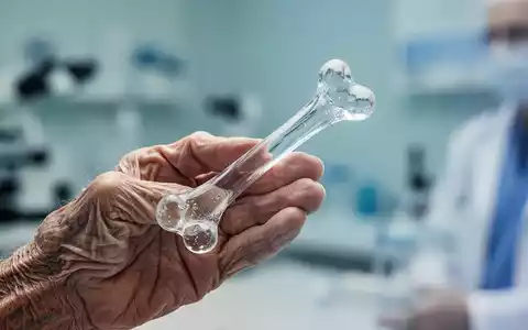 Eine gebrechliche, Ă€ltere Hand hĂ€lt ein zerbrechliches, transparentes Knochenmodell, das das Risiko von KnochenbrĂŒchen symbolisiert. - Foto: ĂŒber boerse-global.de