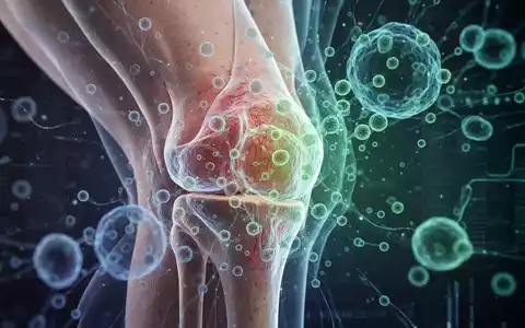 Ein menschliches Kniegelenk mit subtilen Anzeichen von Arthrose, überlagert von abstrakten, leuchtenden blauen und grünen Mustern. - Foto: über boerse-global.de