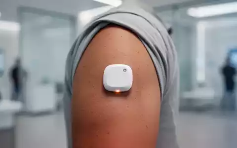 Nahaufnahme eines Dexcom Flex CGM-Sensors am Oberarm eines Erwachsenen, der Glukosewerte in Echtzeit misst. - Foto: über boerse-global.de