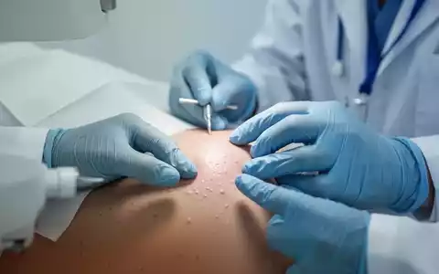 Dermatologische Untersuchung einer Hautveränderung in einer medizinischen Fachpraxis. - Foto: über boerse-global.de