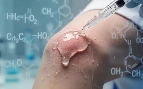 Nahaufnahme einer medizinischen Gellanwendung auf einem Knie zur Behandlung von Gelenkschmerzen. - Foto: über boerse-global.de