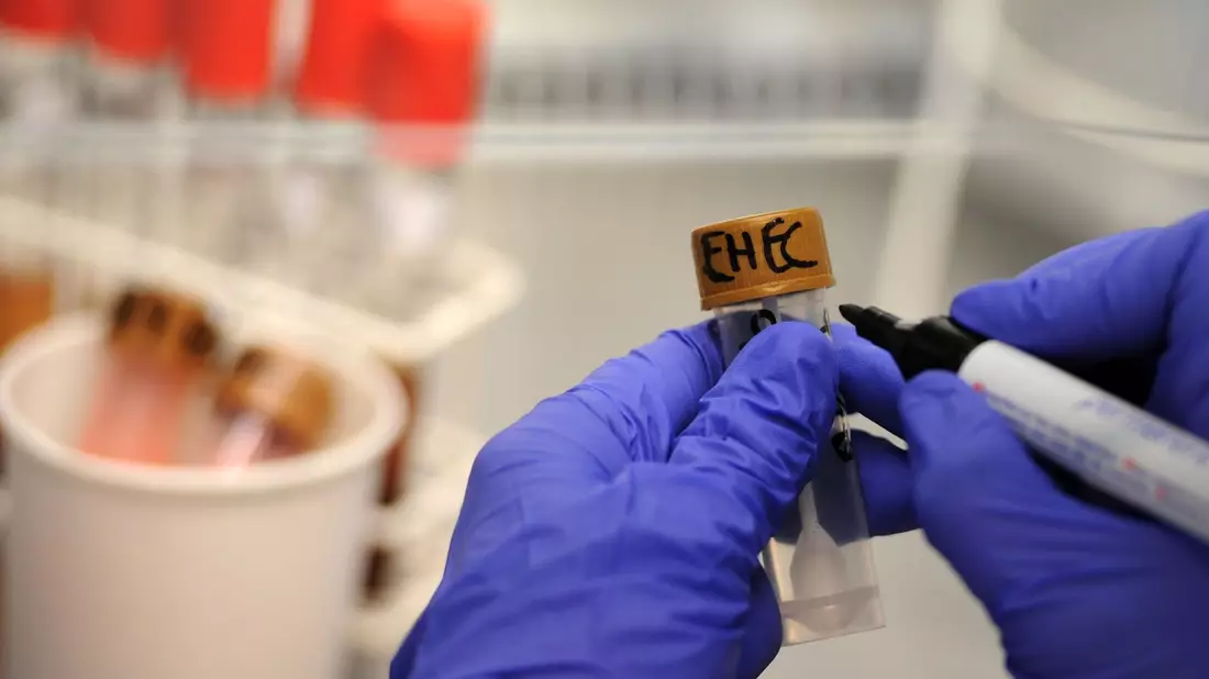 Ehec wird auch in Deutschland jedes Jahr in Tausenden Fällen nachgewiesen, führt aber nur extrem selten zum Tod. (Archivbild) - Bild: Christian Charisius/dpa