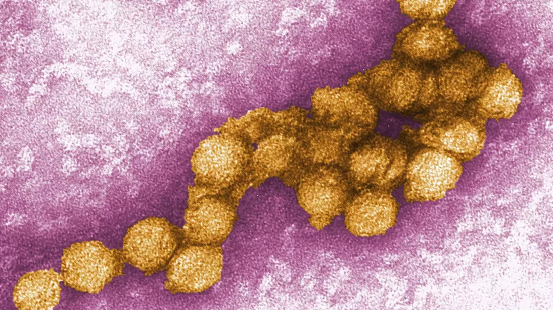 Das West-Nil-Virus unter dem Elektronenmikroskop. - Bild: Cynthia Goldsmith/CENTERS FOR DISEASE CONTROL/EPA/dpa