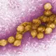 Das West-Nil-Virus unter dem Elektronenmikroskop. - Bild: Cynthia Goldsmith/CENTERS FOR DISEASE CONTROL/EPA/dpa