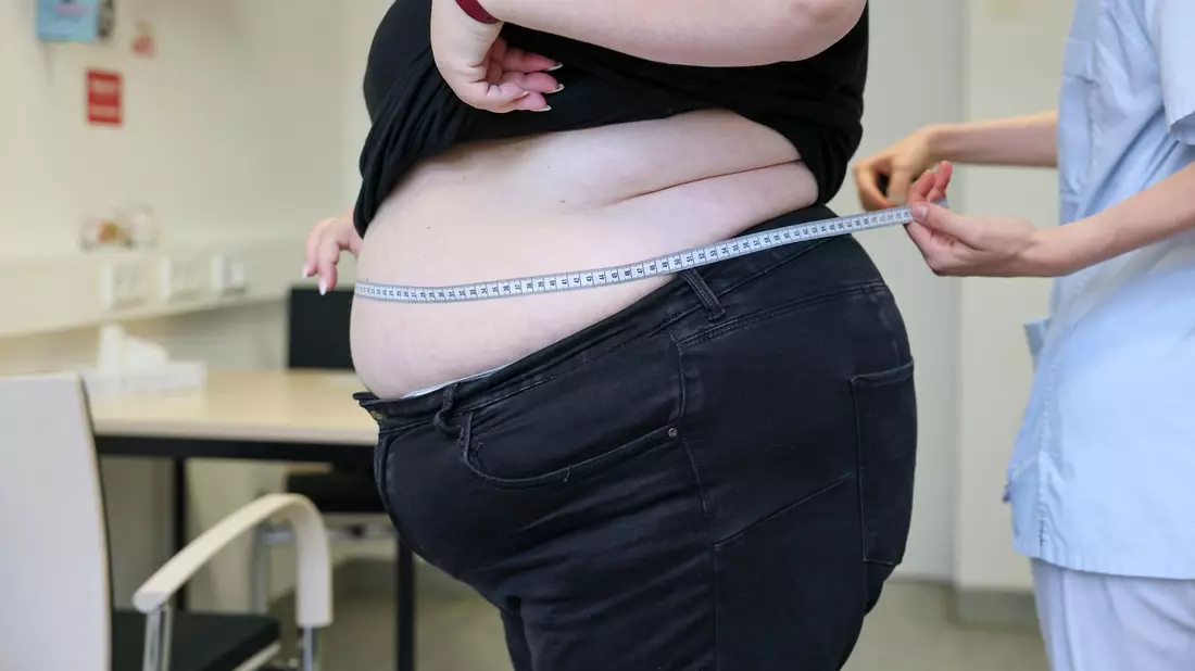 Laut Daten des Statistischen Bundesamtes von 2025 sind in Deutschland 17,9 Prozent der Erwachsenen adipös. (Symbolbild) - Bild: Jan Woitas/dpa