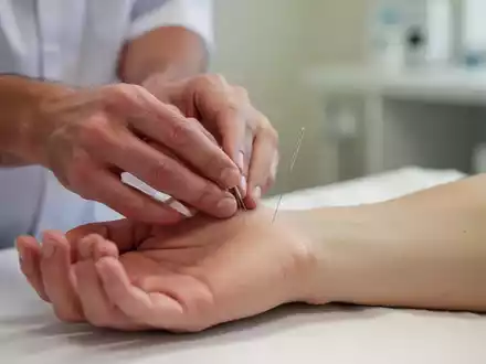 Eine Akupunkteurin setzt eine feine Nadel am Handgelenk eines Patienten zur Behandlung im Rahmen der TCM. - Foto: über boerse-global.de