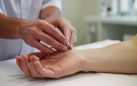 Eine Akupunkteurin setzt eine feine Nadel am Handgelenk eines Patienten zur Behandlung im Rahmen der TCM. - Foto: über boerse-global.de