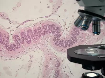 Mikroskopische Aufnahme von biologischem Gewebe der Darmschleimhaut im Labor. - Foto: über boerse-global.de