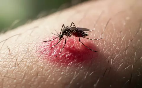 Nahaufnahme eines entzündeten Insektenstichs auf menschlicher Haut bei Tageslicht. - Foto: über boerse-global.de