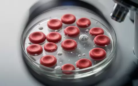 Mikroskopische Aufnahme einer Blutprobe mit Fokus auf die Anzahl der Blutplättchen in einem klinischen Labor. - Foto: über boerse-global.de