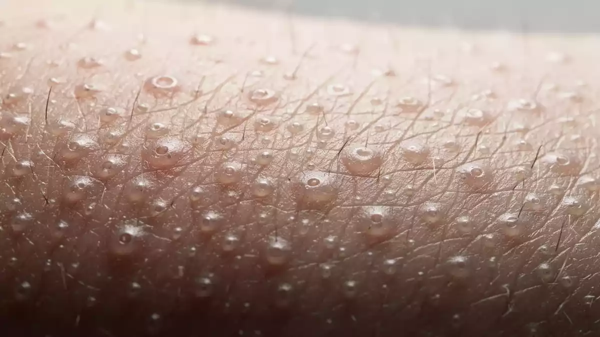 Hautalterung: Studie entschlüsselt Mechanismus hinter Entzündungen