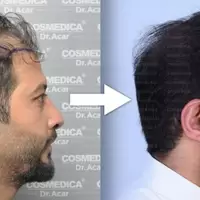  - Foto: cosmedica.com