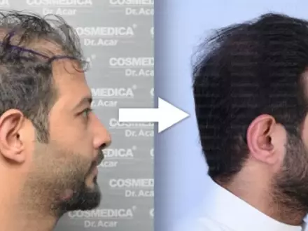  - Foto: cosmedica.com