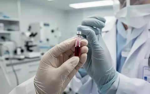 Medizinische Fachkraft in einem modernen Labor bei der Arbeit mit einer Blutprobe für einen Alzheimer-Test. - Foto: über boerse-global.de
