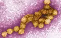 So sieht das West-Nil-Virus unter dem Elektronenmikroskop aus. (Archivbild) - Foto: Cynthia Goldsmith/CENTERS FOR DISEASE CONTROL/EPA/dpa