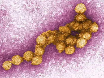 So sieht das West-Nil-Virus unter dem Elektronenmikroskop aus. (Archivbild) - Foto: Cynthia Goldsmith/CENTERS FOR DISEASE CONTROL/EPA/dpa