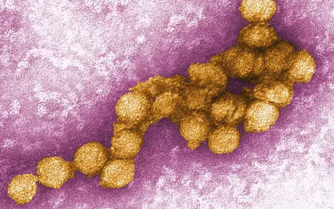 So sieht das West-Nil-Virus unter dem Elektronenmikroskop aus. (Archivbild) - Foto: Cynthia Goldsmith/CENTERS FOR DISEASE CONTROL/EPA/dpa