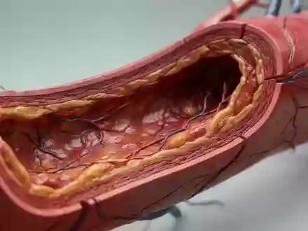 Nahaufnahme einer Querschnittsdarstellung einer menschlichen Arterie mit biologischen Strukturen. - Foto: über boerse-global.de
