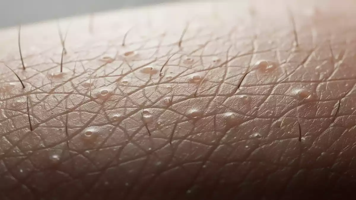 Rosazea und Hautpflege: Ursachen, Schutz und neue Markttrends