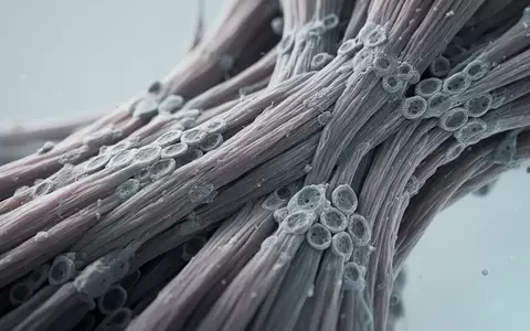 Mikroskopische Aufnahme von menschlichem Skelettmuskelgewebe, die die komplexe zelluläre Struktur und Proteinfilamente zeigt. - Foto: über boerse-global.de