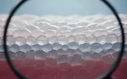 Mikroskopische Aufnahme von menschlichen Hautzellen mit Fokus auf die komplexe Zellstruktur der Keratinozyten. - Foto: über boerse-global.de