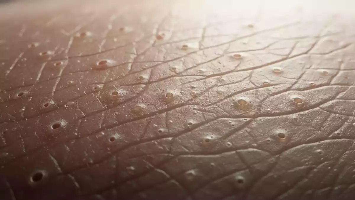 PKP1-Protein steuert Immunreaktion menschlicher Hautzellen