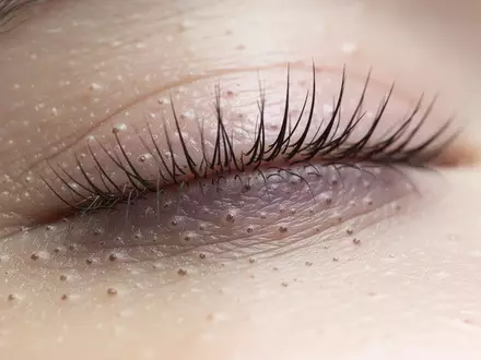 Nahaufnahme der menschlichen Augenlidstruktur und Wimpern bei natürlichem Licht, Fokus auf die Textur der Haut. - Foto: über boerse-global.de