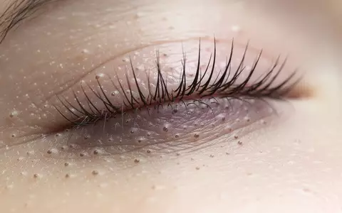 Nahaufnahme der menschlichen Augenlidstruktur und Wimpern bei natürlichem Licht, Fokus auf die Textur der Haut. - Foto: über boerse-global.de