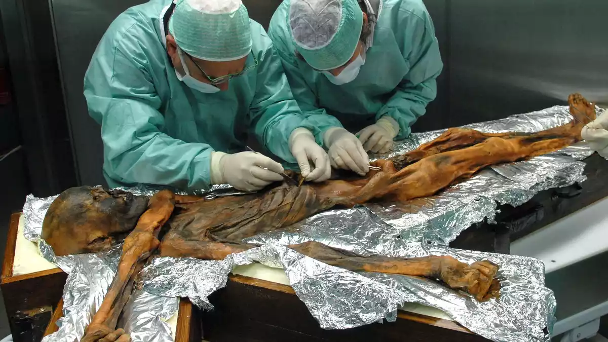 Ötzi wurde hundertfach untersucht - Bild: M.Samadelli/Southtyrolarchaeologymuseum\Eurac via Eurekalert/dpa