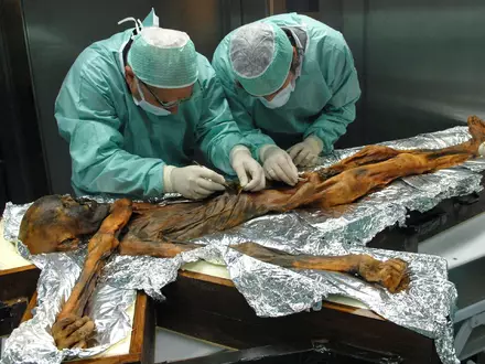Ötzi wurde hundertfach untersucht - Foto: M.Samadelli/Southtyrolarchaeologymuseum\Eurac via Eurekalert/dpa