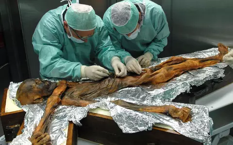 Ötzi wurde hundertfach untersucht - Foto: M.Samadelli/Southtyrolarchaeologymuseum\Eurac via Eurekalert/dpa