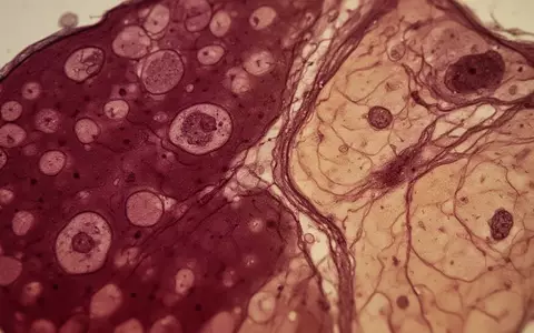 Mikroskopische Aufnahme von Lebergewebe zur Darstellung biologischer Stoffwechselprozesse. - Foto: über boerse-global.de