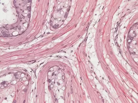 Mikroskopische Aufnahme von Herzmuskelgewebe mit komplexen zellulären Strukturen und organischen Mustern. - Foto: über boerse-global.de